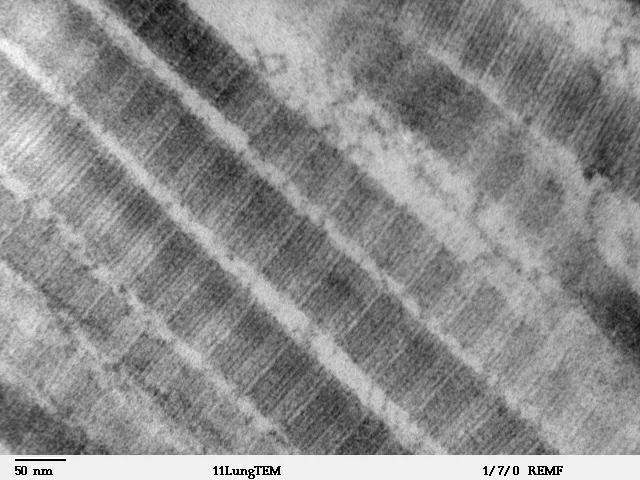 Collagen protein structure essential for skin health
