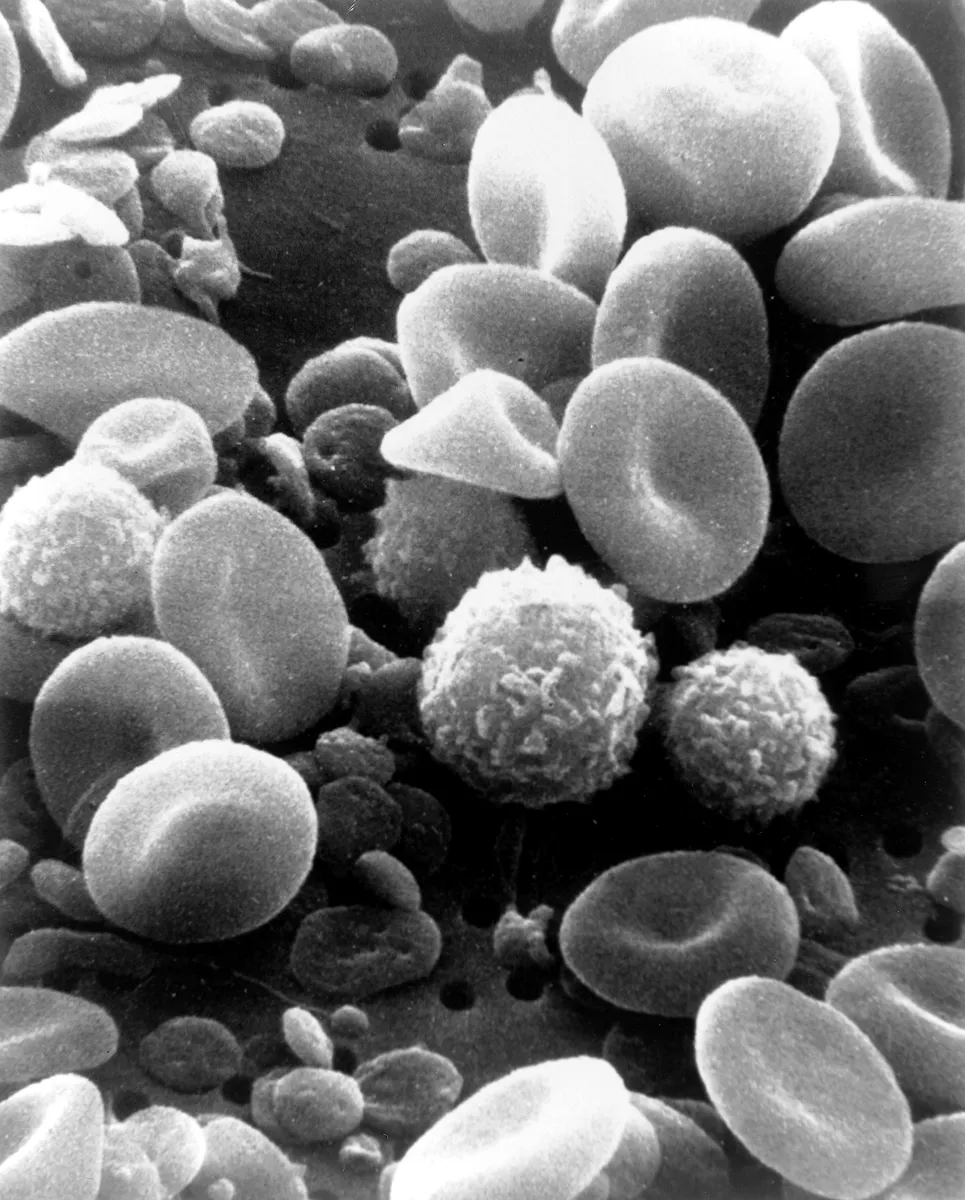 Scanning electron microscope image of blood cells including immune cells
